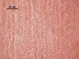 3 – Cellule corticali in visione superficiale